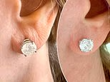My aging, sagging earlobes were one of the surprising things that gave away my age. But at 70, I finally solved them with this simple, quick procedure... and I look 30 years younger: CINDY JACKSON