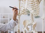 Experimental cancer drug could stop osteoporosis and help women stay slim after menopause
