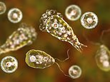 Teen battles rare brain-eating amoeba contracted after swimming in fresh water
