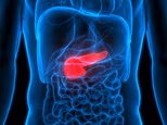 Pancreatic cancer is terrifyingly deadly and there are almost no symptoms until it is too late. But when I analyze the dozens of patients I've treated, there ARE warning signs... including this particular back pain: DR. PHILIPPA KAYE