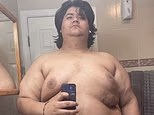 Man, 22, who ate eight-egg omelettes every day and feared he was 'dying' is unrecognizable after losing 120kg without using fat sticks
